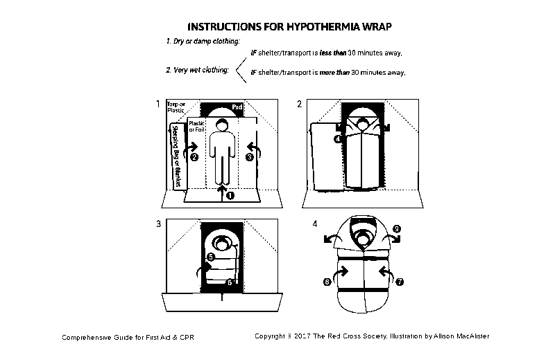 an illustration showing how to make a hypothermia wrap